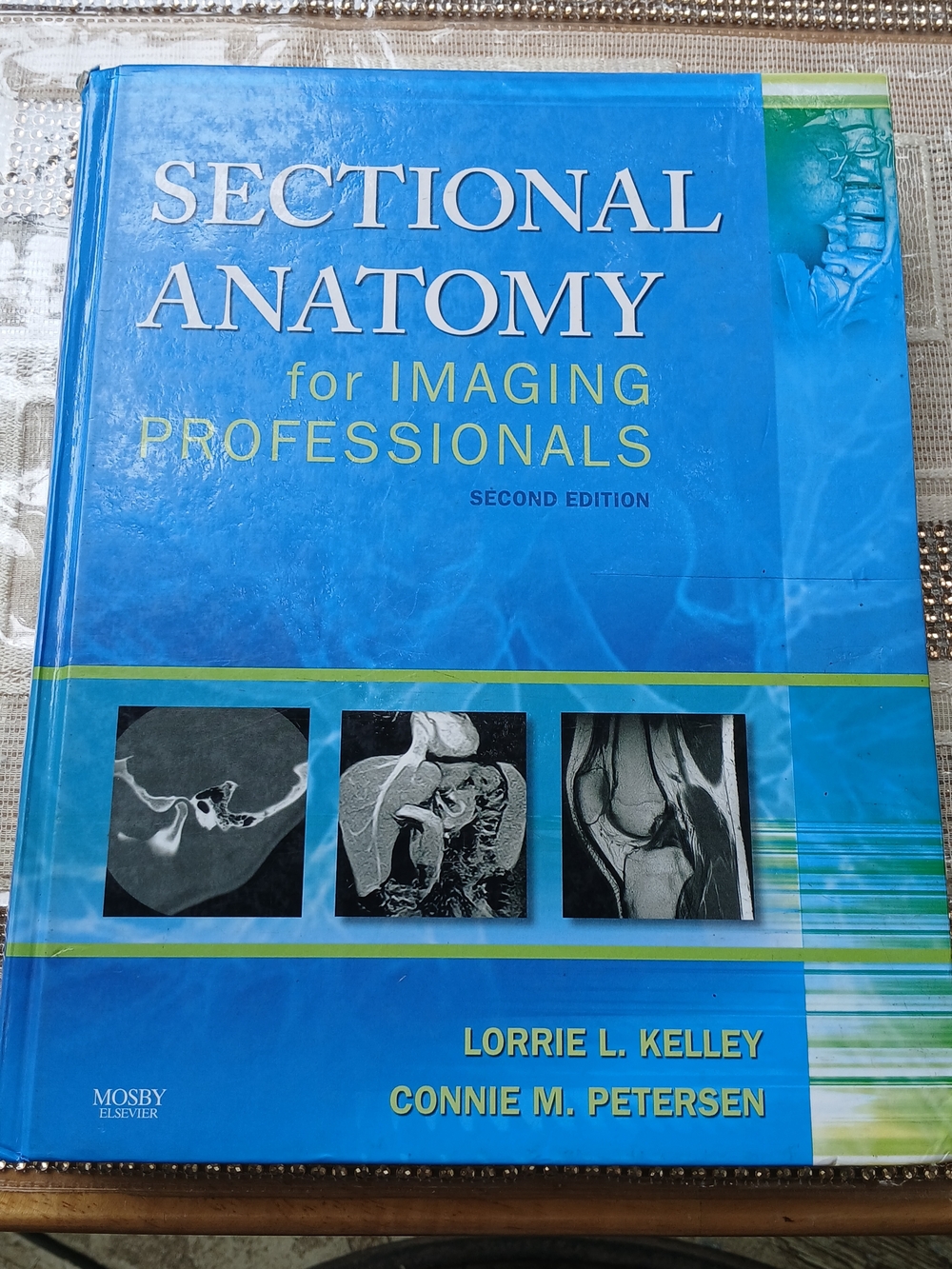 Sectional Anatomy For Imaging Professionals by Lorrie L Kelley